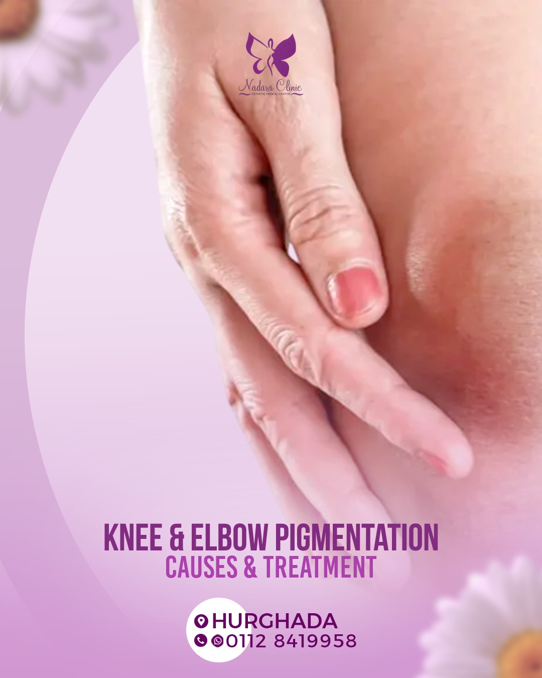 Knee and elbow pigmentation: causes and treatment methods in Hurghada